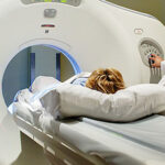 Dépistage du cancer du poumon: Tout savoir sur l’utilisation de la tomodensitométrie (CT scan)